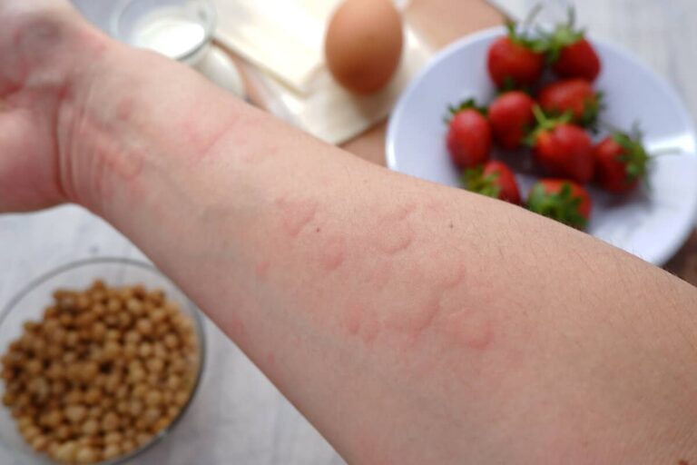 food sensitivity tests: how to test for food allergies & intolerance blog post