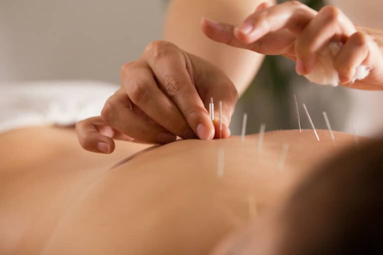 acupuncture and chronic pain: evidence-based benefits blog post