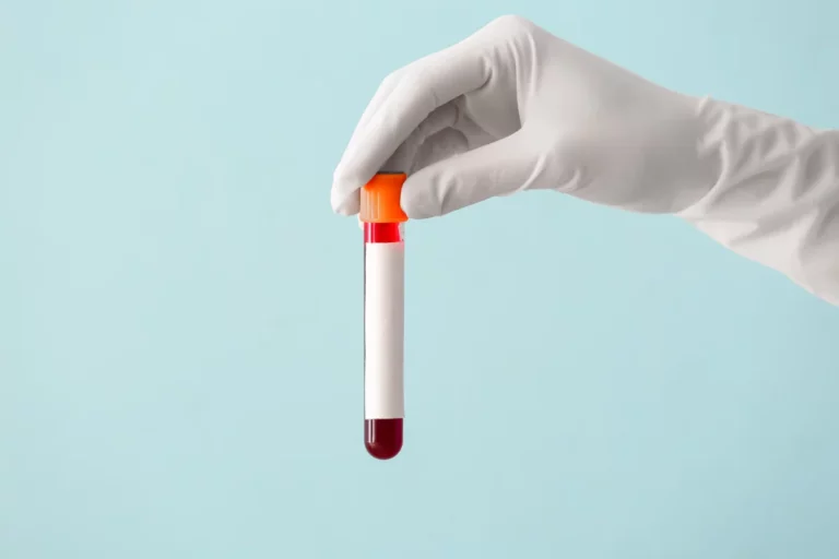 essential nutritional tests registered dietitians can order blog post